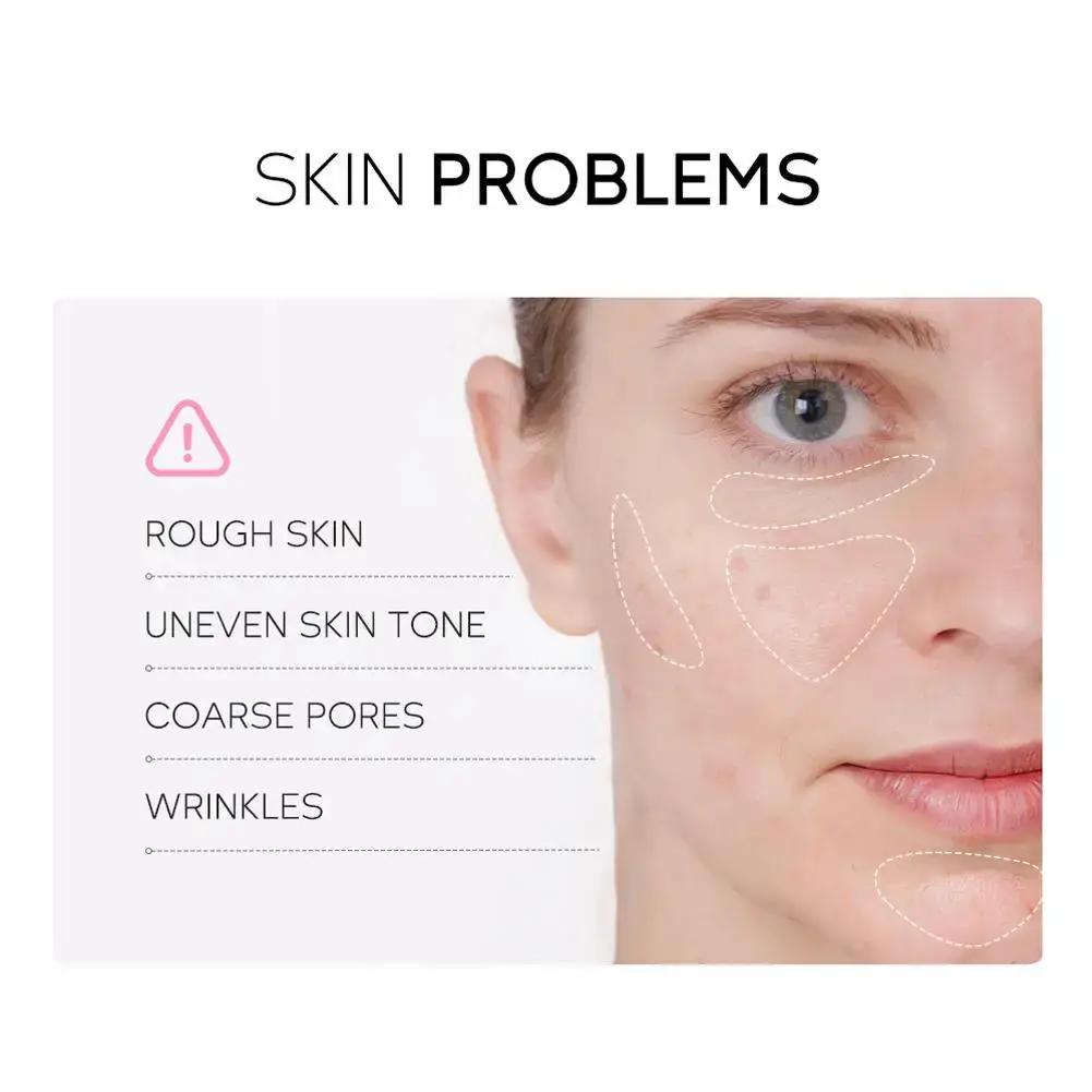 Infographic identifying common skin concerns such as rough skin, uneven skin tone, coarse pores, and wrinkles on a woman's face.