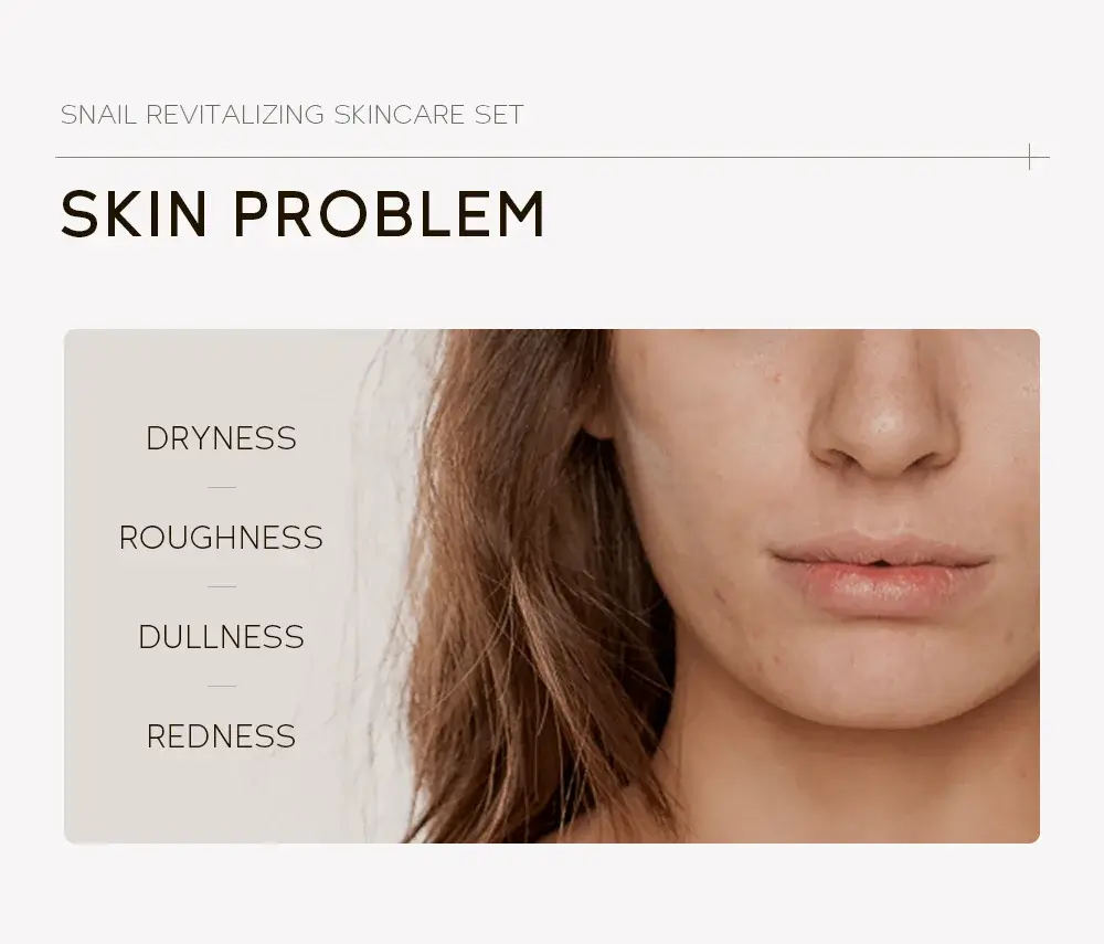 Visual guide to skin problems like dryness, roughness, dullness, and redness addressed by Snail set.