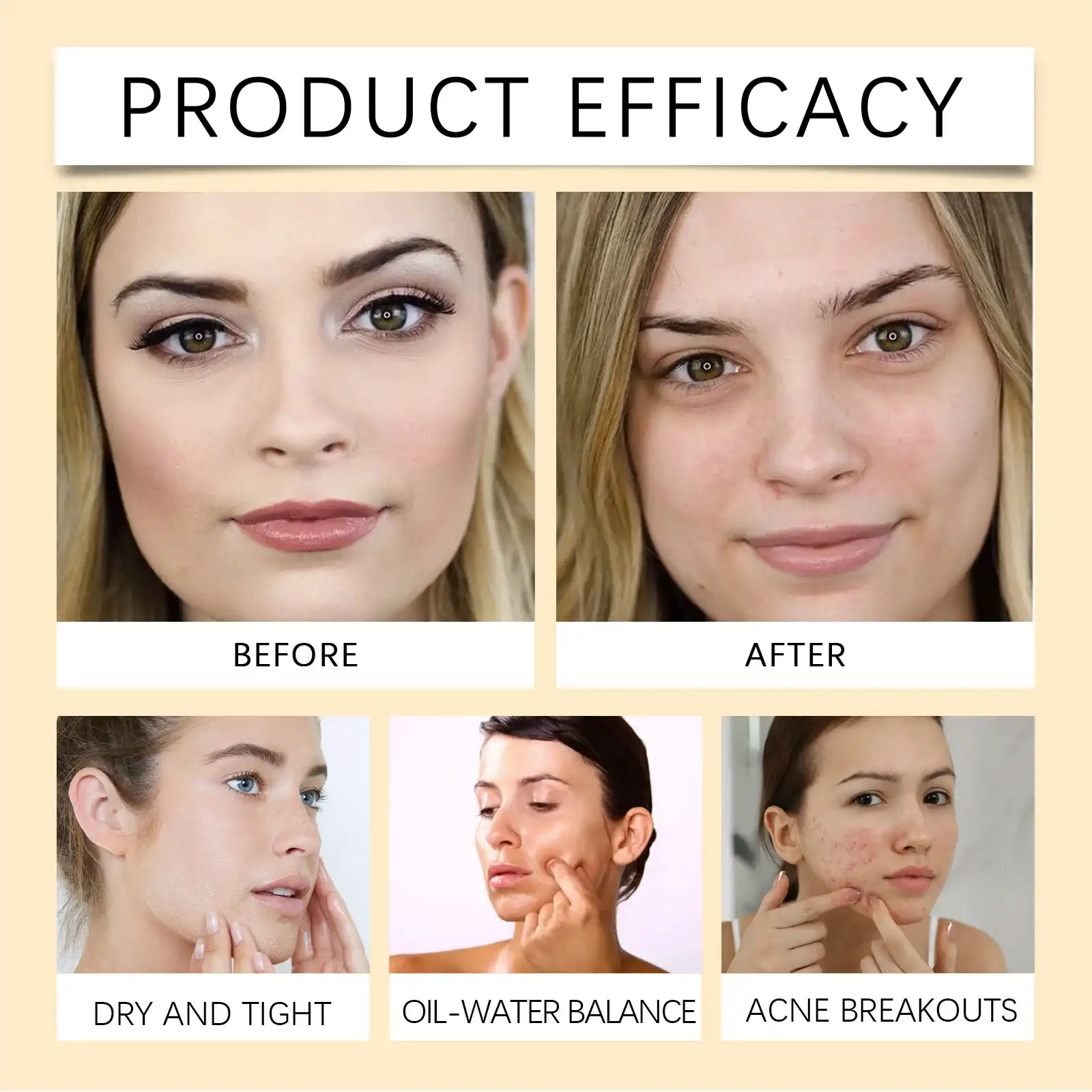 Product efficacy chart showing before and after results for dry skin, oil-water balance, and acne breakouts.