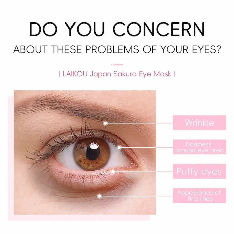 Diagram highlighting common eye concerns like wrinkles, dark circles, and puffy eyes.
