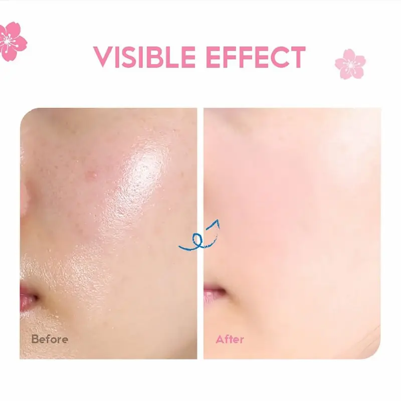 Close-up comparison of skin showing reduced redness and a brighter, more even tone after using the Sakura cream.