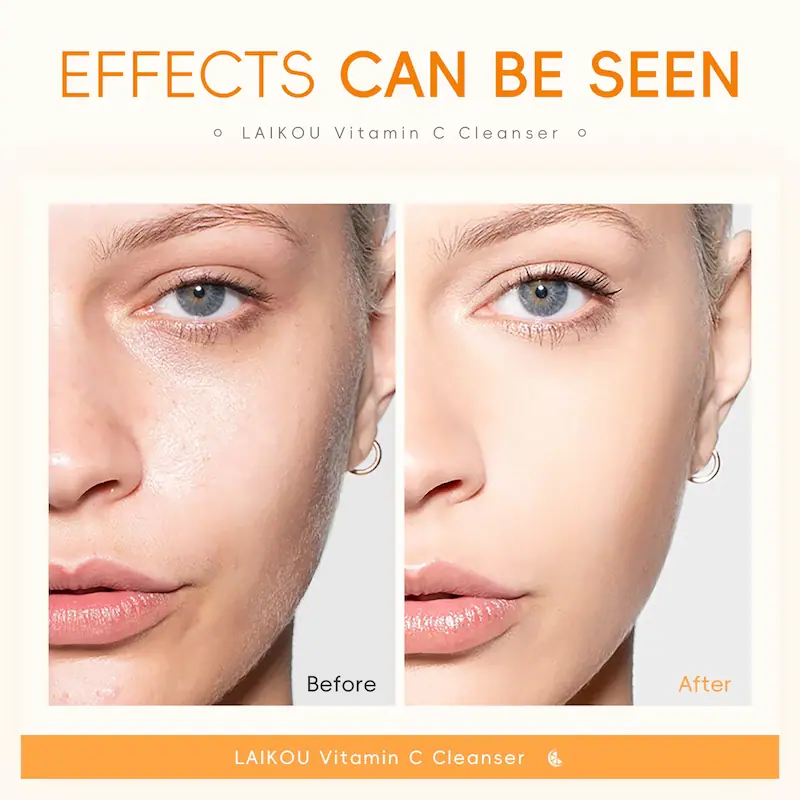 Comparison photos showing skin texture improvement and brightening effects before and after using Vitamin C facial cleanser.