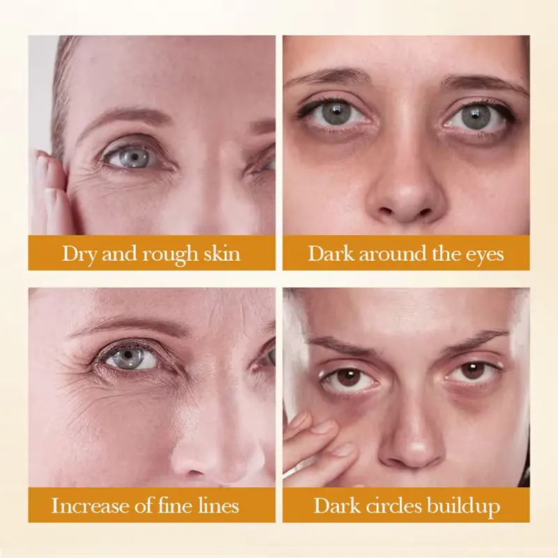Four-panel image highlighting common skin issues like dry skin, dark around eyes, fine lines, and dark circles buildup.