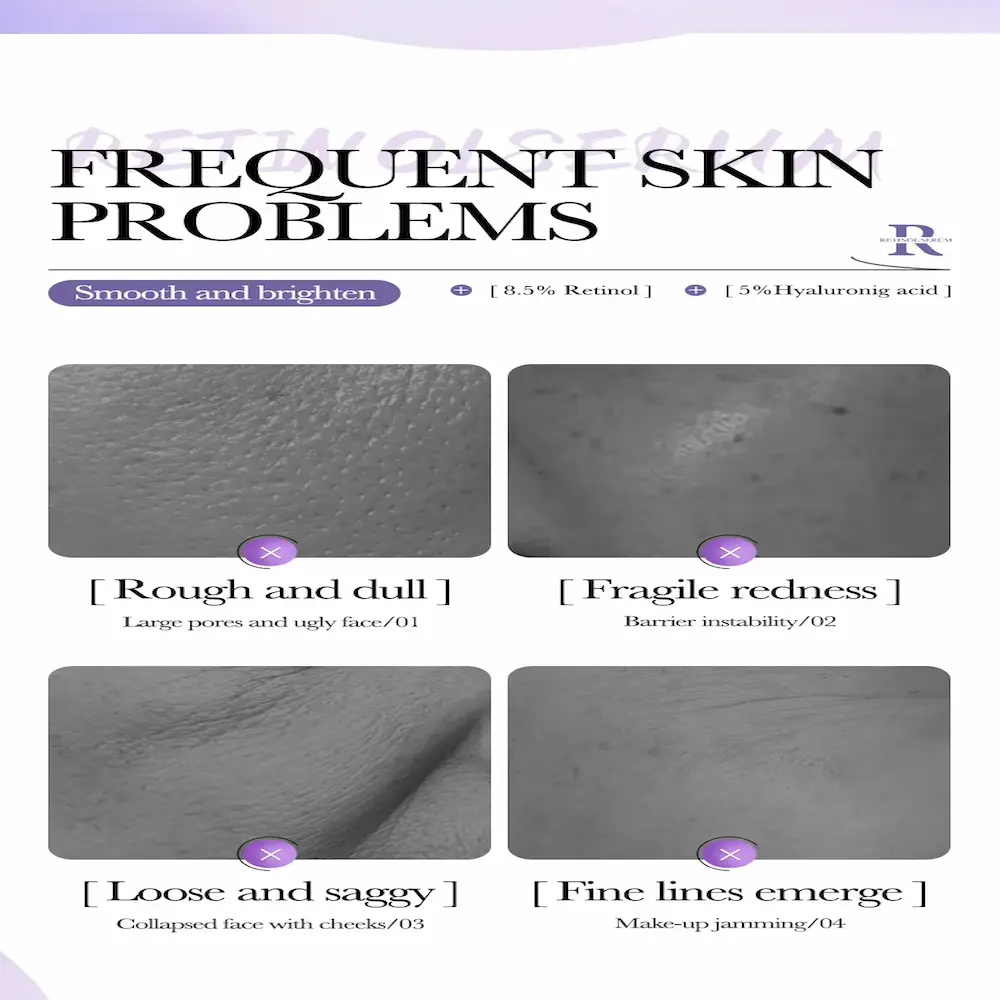 A four-panel image contrasting dull skin, redness, sagging skin, and fine lines with an 'X' over them, showing BIOAQUA Retinol Serum's solutions.